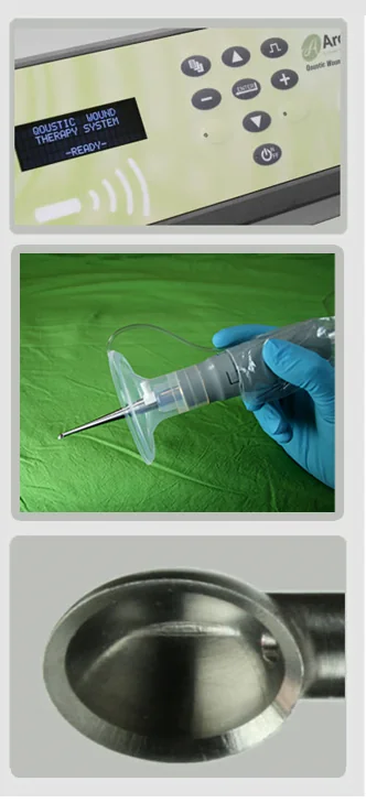 Ultrasound MIST Therapy — Advanced Therapy · Qoustic Wound Therapy System™